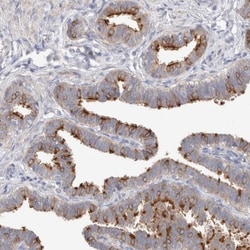 AADAC Antibody, Novus Biologicals:Antibodies:Primary Antibodies